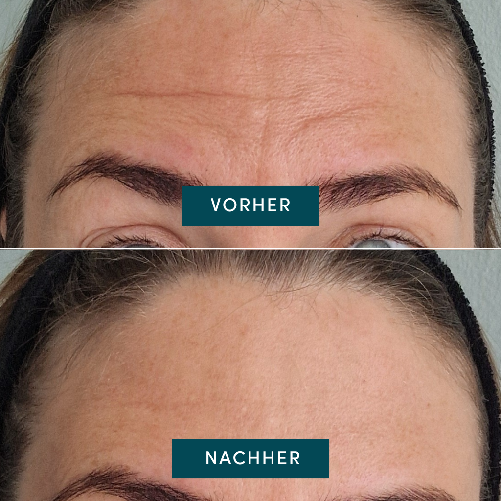 APRICOT višekratni jastučići za oči s Vitaminom C - Slika 3